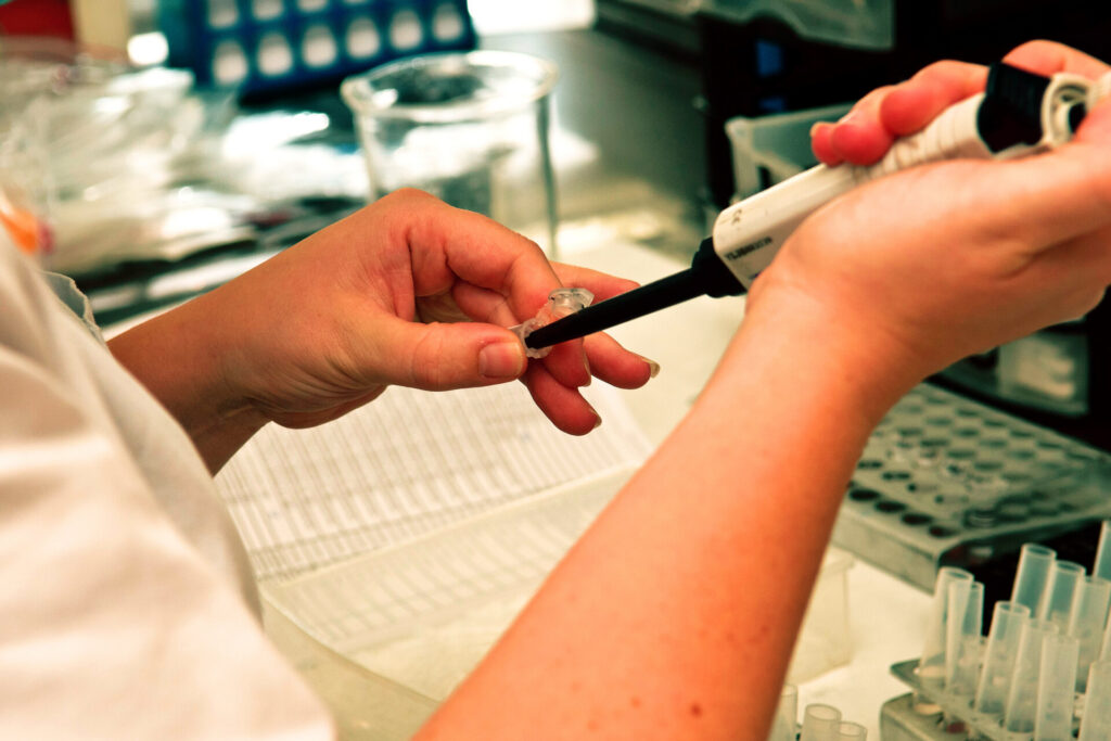 Blood draw